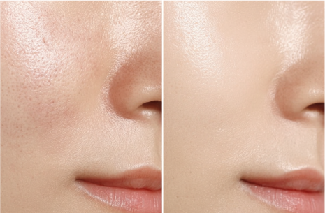 사진=데자뷰메디스킨